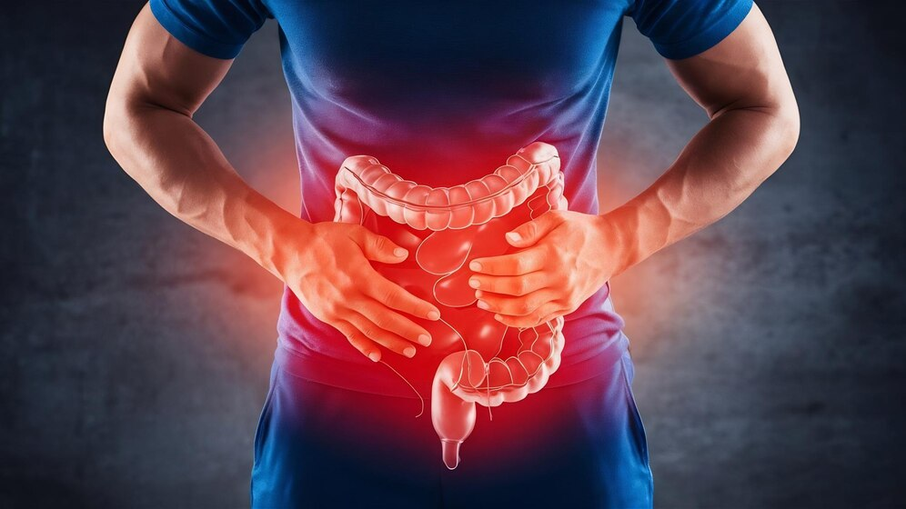 Gastrointestinal-Disorders